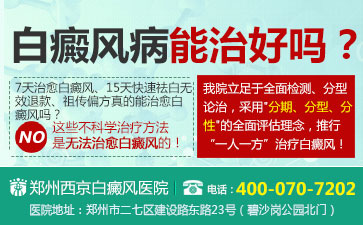 白癜风复发跟饮食有关系吗 白癜风复发跟饮食有关系吗